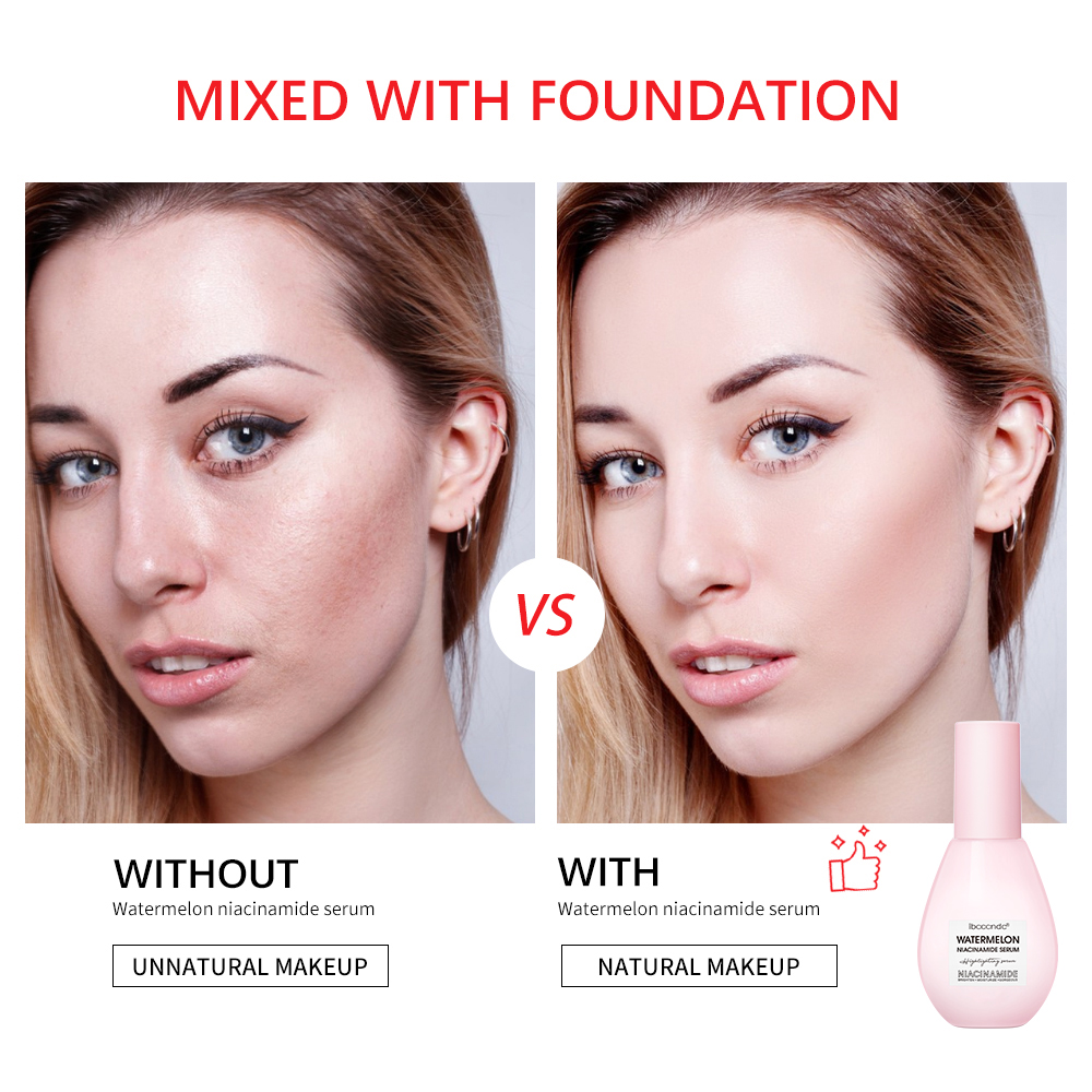 ใหม่แตงโม nicotinamide หลอดไฟ  - Substrate Coconut Fiber บทวิจารณ์และราคา
